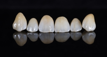 Zirconiul dentar , un nou standard in stomatologie